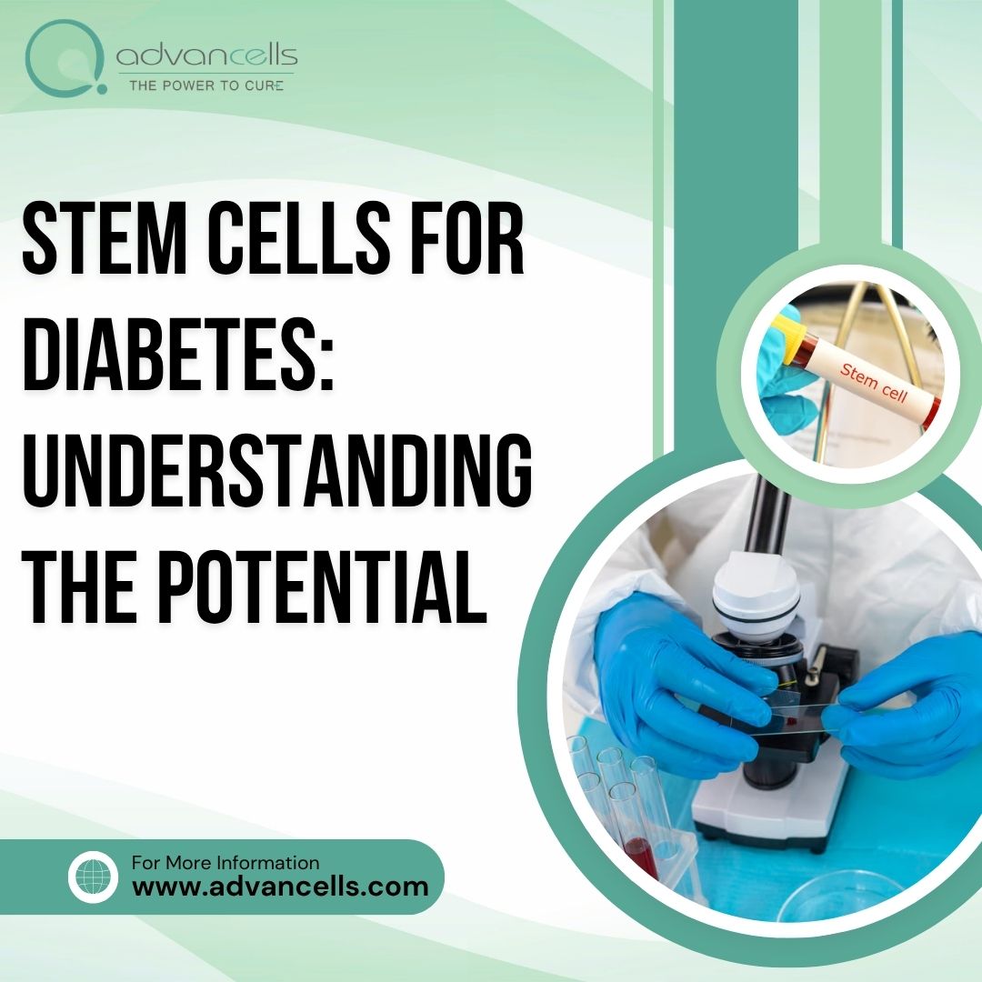 Stem Cells for Diabetes: Understanding the Potential