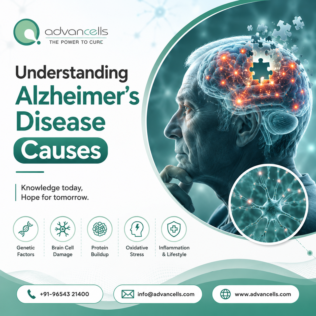 Understanding Alzheimer's Disease Causes